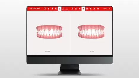 Software
