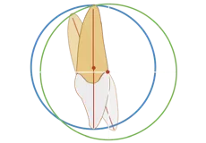 Intelligent Rotation Center
