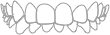 Protrusion
