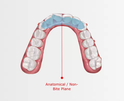 Mandibular Repositioning Device with Bite Plane