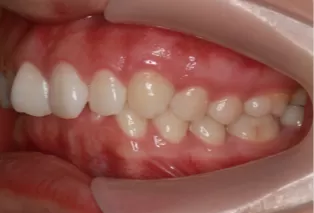 Intraoral photos