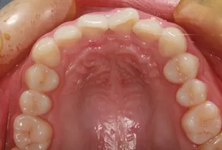 Intraoral photos
