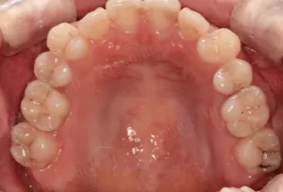 Intraoral photos
