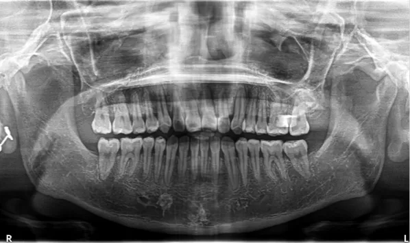 X-rays after treatment