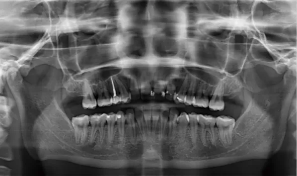 X-rays before treatment