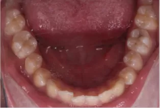 Intraoral photos