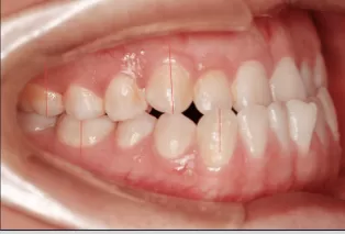 Intraoral photos