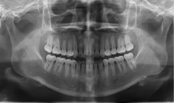 X-rays before treatment
