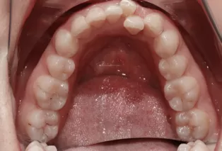 Intraoral photos