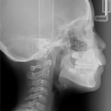 X-rays before treatment