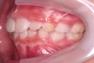 Intraoral photos