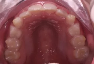 Intraoral photos