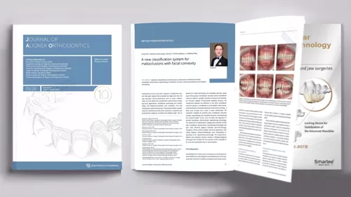 New Classification System of Malocclusions Published in the Journal of Aligner Orthodontics (JAO) by Prof. Gang Shen's Team