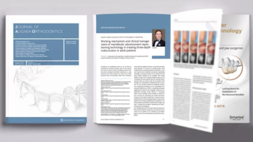 Prof. Gang Shen’s Research Paper about Mandibular Advancement Repositioning Technology in the Journal of Aligner Orthodontics